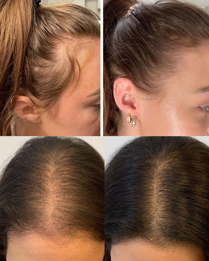 CEPILLO ANTACAÍDA NUVÉRA + TÓNICO CAPILAR Y FUNDAS DE SATÉN DE REGALO